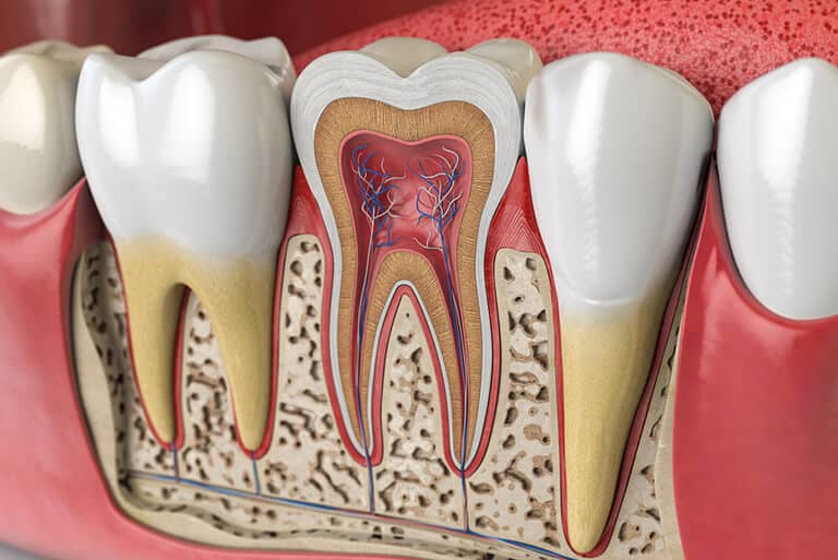 Do Root Canals Cause Cancer