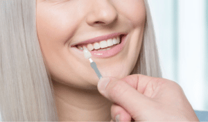 Which Veneers Look The Most Natural