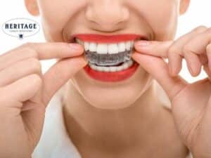 Do I Need Invisalign Refinements