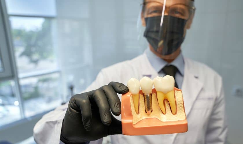 Dental Implants Gaps to Gorgeous