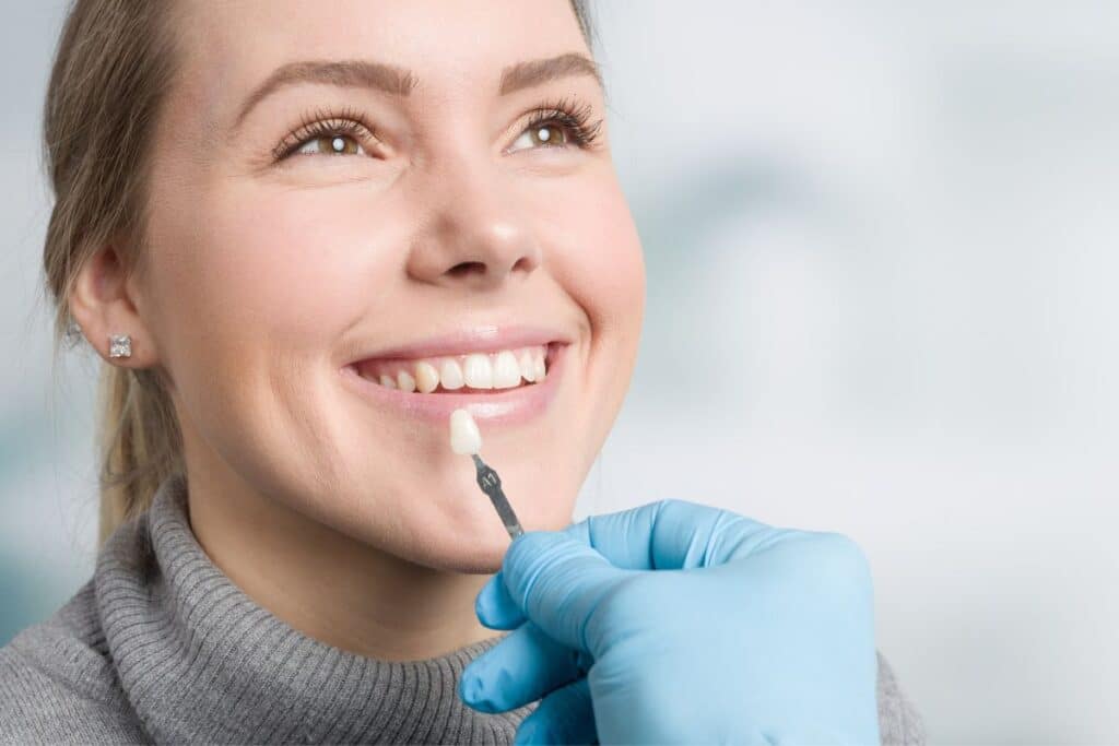 Dental Veneers in Frisco