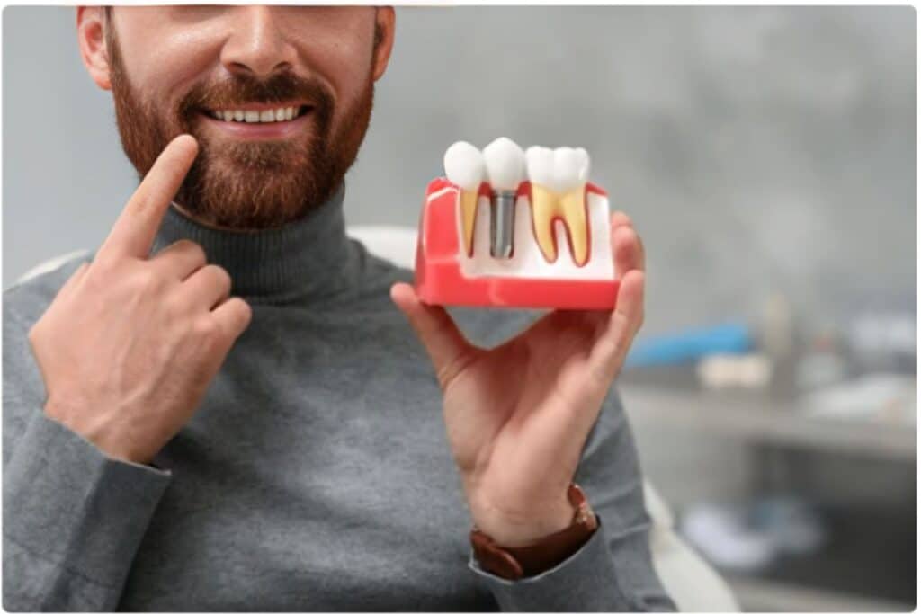 Dental Implants in Frisco