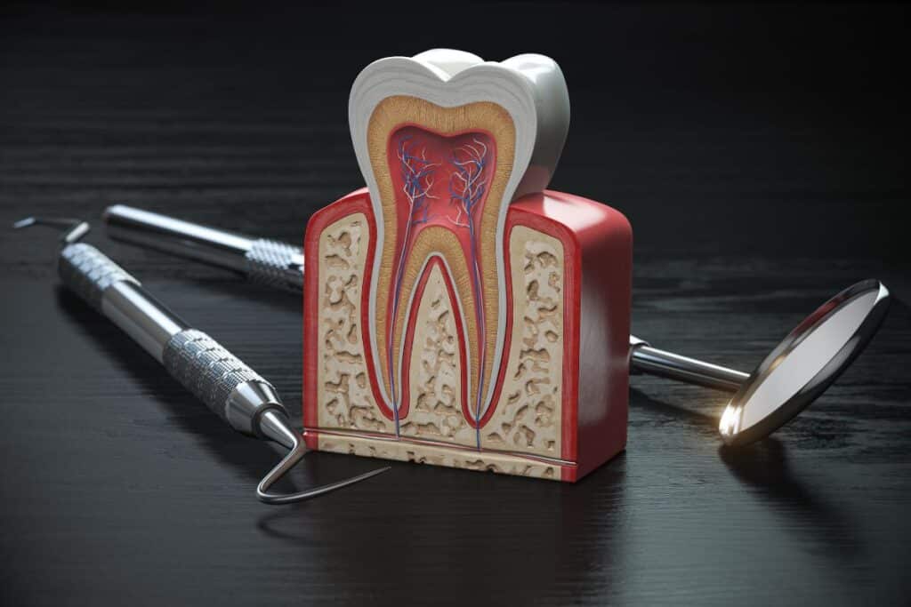 the Right Endodontist for Your Root Canal