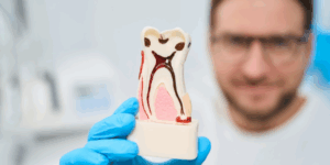 Root Canals Aren’t Scary