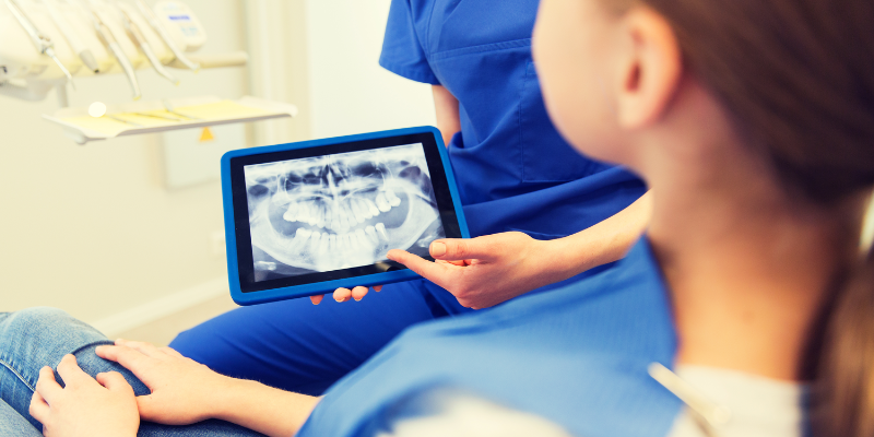 Pediatric Dental X-Rays