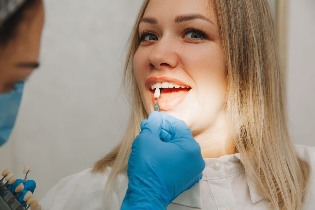 dental veneers north dallas