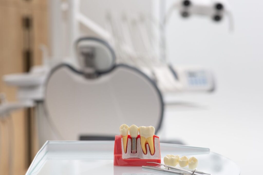 dental implants with bone loss