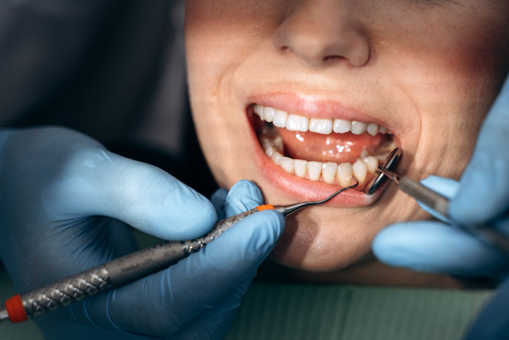 Dentist performing a routine dental examination and cleaning on a patient in North Dallas, TX