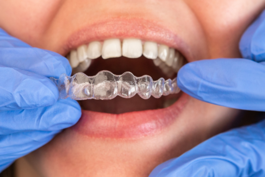 Dentist reviewing a customized Invisalign® treatment plan with a patient at Heritage Family Dentistry in North Dallas, TX.